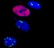 Detection of DNA-damage foci (green spots) with 53BP1 antibody staining and detection of cells in S-phase with EdU staining (red nuclei).
