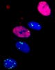 Detection of DNA-damage foci (green spots) with 53BP1 antibody staining and detection of cells in S-phase with EdU staining (red nuclei)