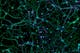 Cortical Neurons stained for DNA, Microtubules and Microtubule-associated Proteins
