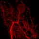 Purkinge cell - Image courtesy of: Carolina Borges-Merjane, Oregon Health & Science University
