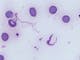 Trypanosoma brucei gambiense parasite in human blood smear