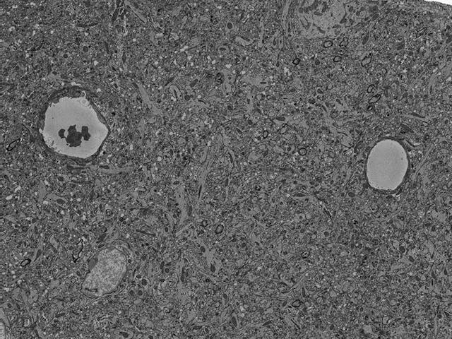Large field oBrain section, large field of view, imaged using 3View® in combination with GeminiSEM 300.f view of a brain section imaged using 3View® in combination with GeminiSEM 300.