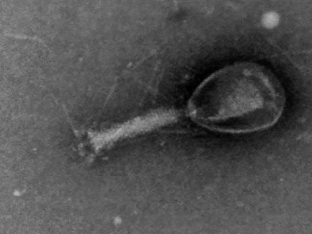 T4-Phage, negative stained, imaged with a STEM detector