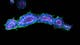 Aus mIMCD3-Zellen gewachsene Nierentubulusorganoide