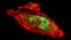 腺がん細胞の3Dイメージング。顕著なミトコンドリア核分裂パターンが示されている