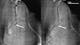 Die Stromuli sind in den mit Crossbeam aufgenommenen Schnittebenen gut sichtbar.