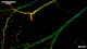 SIM² Apotome und Lattice SIM² Bilder eines den neuronalen Marker Thy1-eGFP exprimierenden Mäusegehirns. Die Bilder zeigen die farbcodierten Maximumintensitätsprojektionen der Volumendaten.