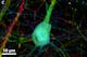 Schnitt eines Thy1-YFP-Mäusegehirns - einzelne Nervenzelle