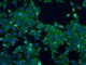 HeLa cells - 2-channel fluorescence