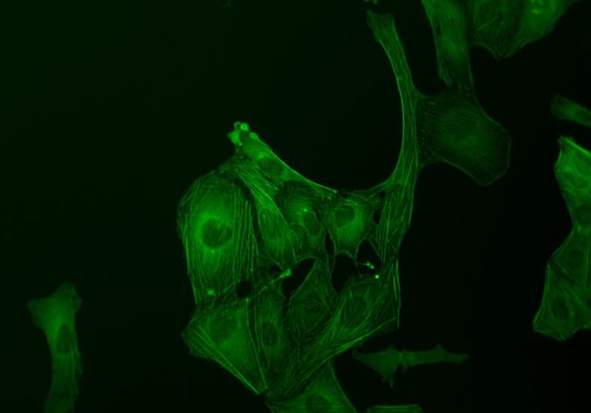 U2OS cells, GFP stained, fluorescence contrast