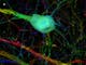 Schnitt eines Thy1-YFP-Mäusegehirns - eine einzelne Nervenzelle
