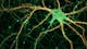 Cultured rat hippocampal neuron