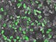 HeLa cells transfected with GFP expression plasmid