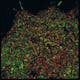 Fusion proteins acquired with Elyra 7 using super resolution microscopy with fluorescence