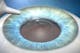 Eye anaesthesia