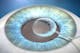 Protejarea porțiunii interne a ochiului