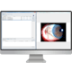 ZEISS FORUM LINK net ophthalmology software