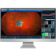 Retina Workplace ophthalmology software
