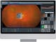 ZEISS Retina Workplace - Completely integrated multimodality software