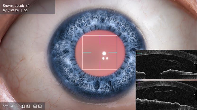 test ocular online astigmatism imagini pentru restabilirea vederii