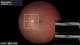 Retina surgery with integrated intraoperative OCT