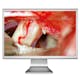 OPMI Sensera Video Displays in ENT surgery