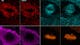 Cos-7-Zellen, aufgenommen mit ZEISS LSM Plus. Die Fluoreszenzsignale wurden durch Lineares Entmischen (Linear Unmixing) getrennt, was die klare Separierung spektral überlappender Farbstoffe erleichtert. Copyright: U. Ziegler und J. Doehner, Universität Zürich, ZMB, Schweiz