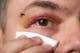 Applicare qualcosa di freddo sull'occhio subito dopo una lesione può ridurre il gonfiore e lenire il dolore.