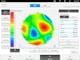 i.Profiler plus features a high- resolution wavefront measurement and corneal topography